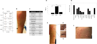 Human vs Machine in Bioengineering Allergology: A Comparative Analysis of Conventional vs Innovative Methods for Quantifying Allergological Skin Prick Tests