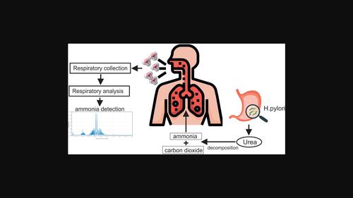 Ammonia measurement in human breath of subjects with Helicobacter pylori using photoacoustic spectroscopy