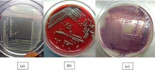 Co-production of metallo-β-lactamase and OXA-type β-lactamases in carbapenem-resistant Acinetobacter baumannii clinical isolates in North East India