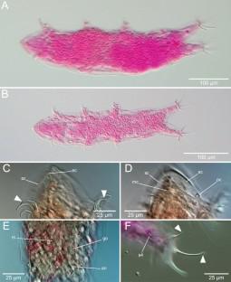 Novel distribution records of marine Tardigrada from abyssal sediments of the Northwest Atlantic Ocean