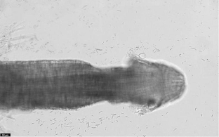 Mechanism of benzoxazinoids affecting the growth and development of Fusarium oxysporum f. sp. fabae