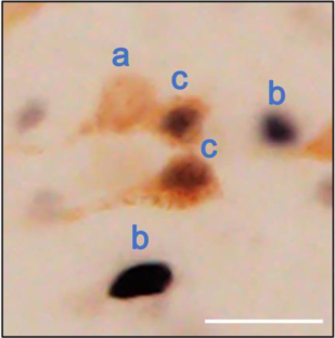 Recruitment of hippocampal and thalamic pathways to the central amygdala in the control of feeding behavior under novelty