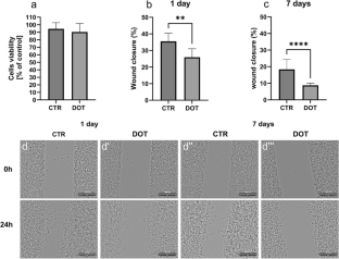 Gadolinium retention effect on macrophages — a potential cause of MRI contrast agent Dotarem toxicity