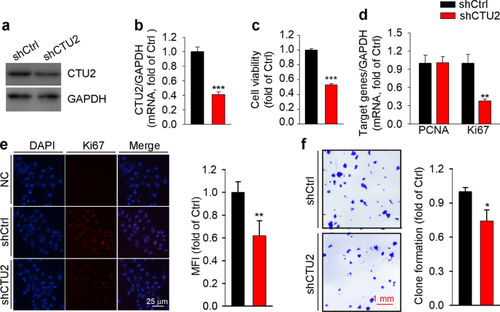 Activation of CTU2 expression by LXR promotes the development of hepatocellular carcinoma