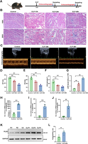 PLD2 deletion ameliorates sepsis-induced cardiomyopathy by suppressing cardiomyocyte pyroptosis via the NLRP3/caspase 1/GSDMD pathway