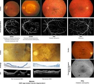 Multimodality Fusion Strategies in Eye Disease Diagnosis