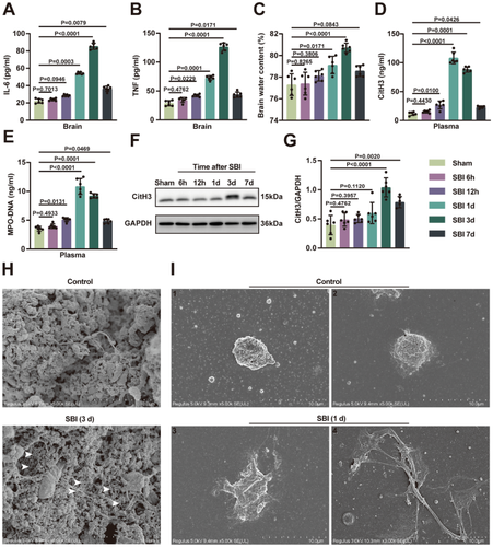 Neutrophil Extracellular Traps Regulate Surgical Brain Injury by Activating the cGAS-STING Pathway