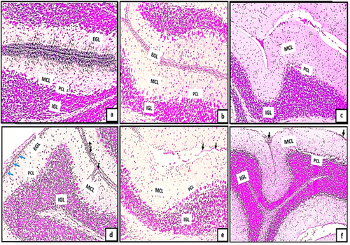 Evaluation of histological and ultrastructural changes provoked by prenatal tramadol on postnatal cortical cerebellar neuronal development in rats: possible implication of Ki67, GFAP and MicroRNA-7/P53 signalling trajectories