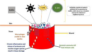 Narrative review on nanoparticles based on current evidence: therapeutic agents for diabetic foot infection