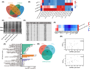 miR-451a was selectively sorted into exosomes and promoted the progression of esophageal squamous cell carcinoma through CAB39