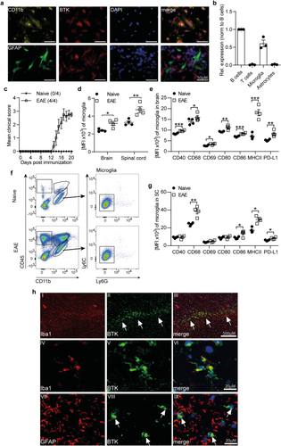 BTK inhibition limits microglia-perpetuated CNS inflammation and promotes myelin repair