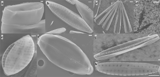 Widespread Production of Polyunsaturated Aldehydes by Benthic Diatoms of the North Pacific Ocean's Salish Sea.