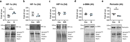 Ischemia does not provoke the full immune training repertoire in human cardiac fibroblasts