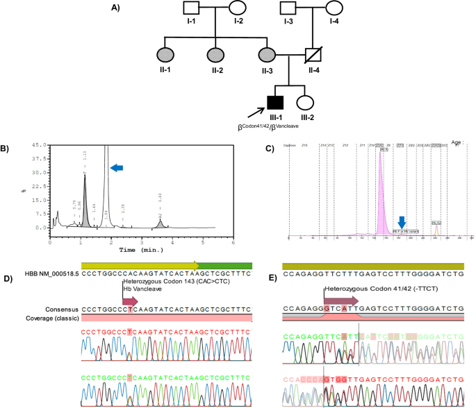 Rare coinheritance of hemoglobin vancleave with severe beta-thalassemia mutation in a patient with secondary erythrocytosis