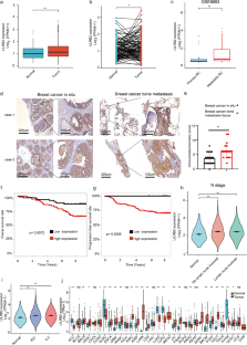 LILRB2 promotes immune escape in breast cancer cells via enhanced HLA-A degradation.