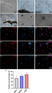 Adult hair follicle stem cells differentiate into neuronal cells in explanted rat intestinal tissue.