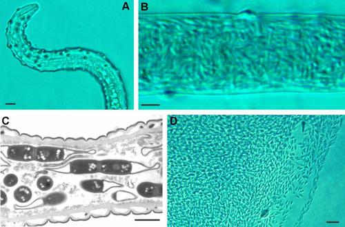 The cryptic microbiota of plant parasitic and entomopathogenic nematodes: diversity, effects on host biology and potential in plant protection