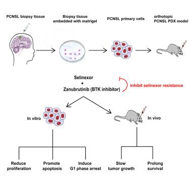 Zanubrutinib delays selinexor resistance evolution in biopsy sample-derived primary central nervous system lymphoma models