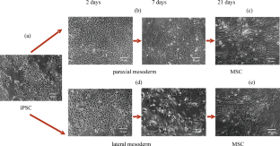 Expression Profile of Isogenic Early Mesodermal Cells Differentiated from Human Induced Pluripotent Stem Cells