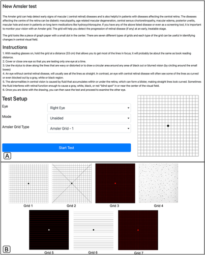 Evaluation of a Digital Amsler Grid (PocDoc) for Macular Disease Screening: A Comparative Analysis with the Conventional Method.