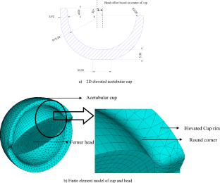 Effect of Elevated Acetabular Cup on Contact and Failure Analysis in Hip Implants for Different Microseparations and Cup Inclinations Under Routine Gait Activities Using In Silico Approach