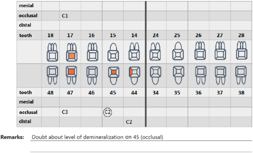 Eligibility of a novel BW + technology and comparison of sensitivity and specificity of different imaging methods for radiological caries detection