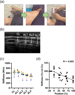 Regional variations and sex-related differences of stiffness in human tracheal ligaments