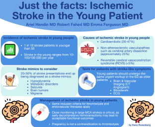 Just the facts: Ischemic stroke in the young patient