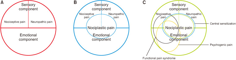 Current understanding of nociplastic pain.