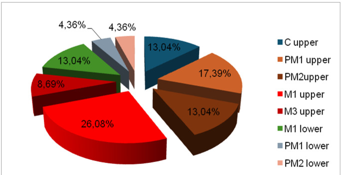 Cracked Teeth and Vertical Root Fractures in Pandemic Crisis - Retrospective Study.
