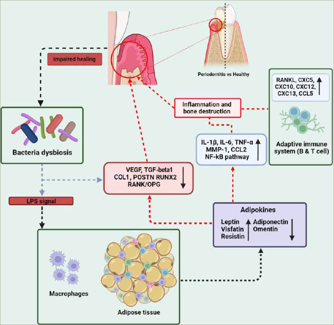 Obesity and Oral Health: The Link Between Adipokines and Periodontitis.