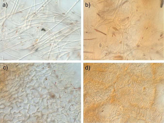 Description, identification, and growth of Tuber borchii Vittad. mycorrhized Pinus sylvestris L. seedlings on different lime contents.