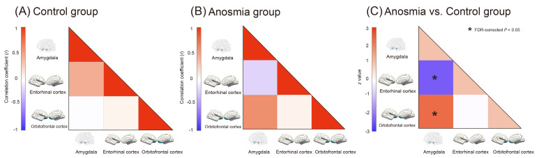 Changes in Structural Covariance among Olfactory-related Brain Regions in Anosmia Patients.