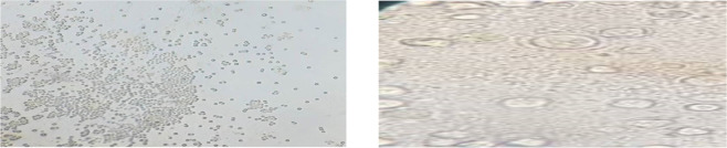 Isolation and Molecular Identification of Vahlkampfiidae and <i>Vermamoeba Vermiformis</i> from Fresh Vegetables: A Neglected Source of Infections.