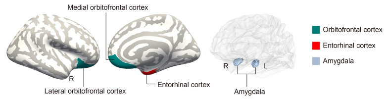Changes in Structural Covariance among Olfactory-related Brain Regions in Anosmia Patients.