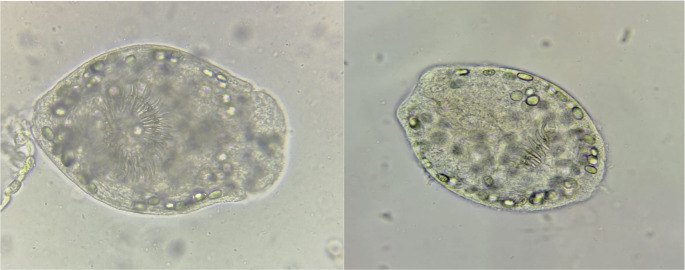 Investigation of Mitochondrial <i>Cytb</i> Gene Region of Both <i>Echinococcus granulosus</i> Eggs from Dogs and Cystic Echinococcosis Isolates Obtained from Sheep and Cattle by Molecular Methods.
