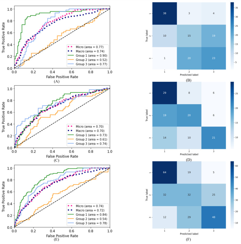 Automatic Spontaneous Speech Analysis for the Detection of Cognitive Functional Decline in Older Adults: Multilanguage Cross-Sectional Study.