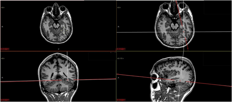 Why did humans surpass all other primates? Are our brains so different? Part 2.