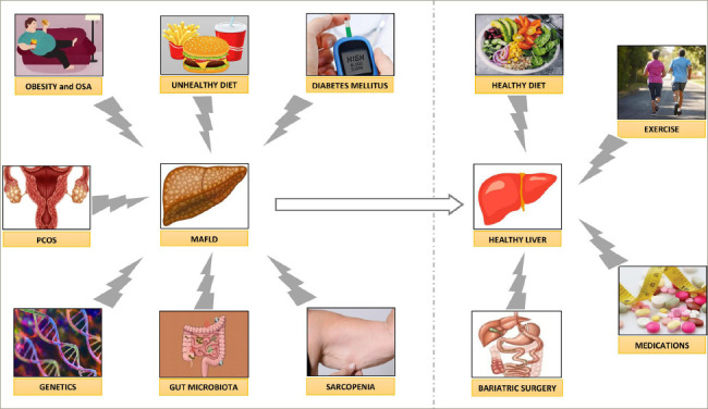 Metabolic Dysfunction-associated Fatty Liver Disease: An Urgent Call for Global Action.