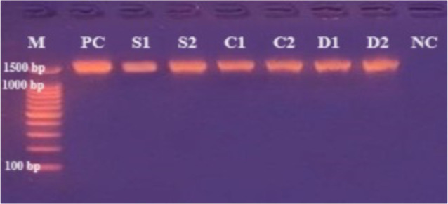 Investigation of Mitochondrial <i>Cytb</i> Gene Region of Both <i>Echinococcus granulosus</i> Eggs from Dogs and Cystic Echinococcosis Isolates Obtained from Sheep and Cattle by Molecular Methods.