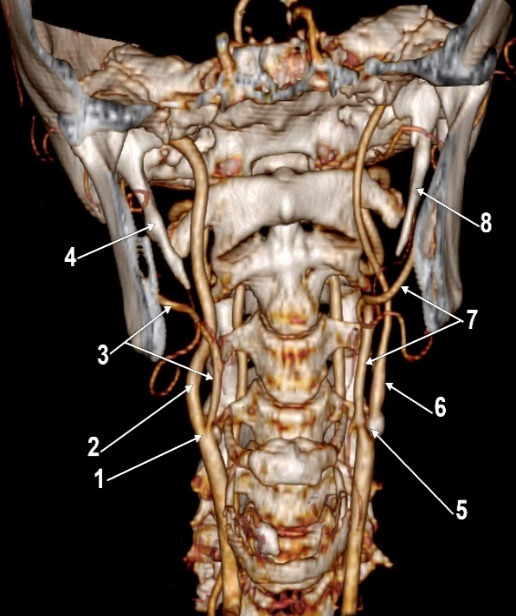 The External Carotid Artery and the Styloid Process.