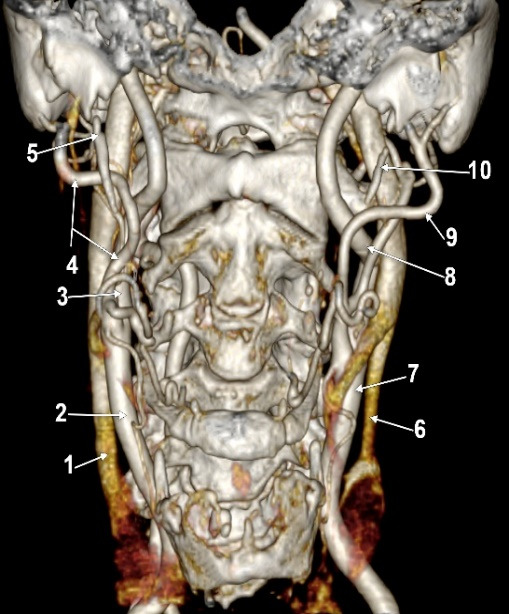 The External Carotid Artery and the Styloid Process.