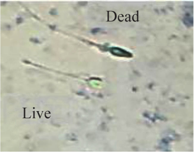 Comparative Analysis of the Effects of Magnesium Oxide Nanoparticles on Sperm Parameters in Fresh and Frozen Samples.