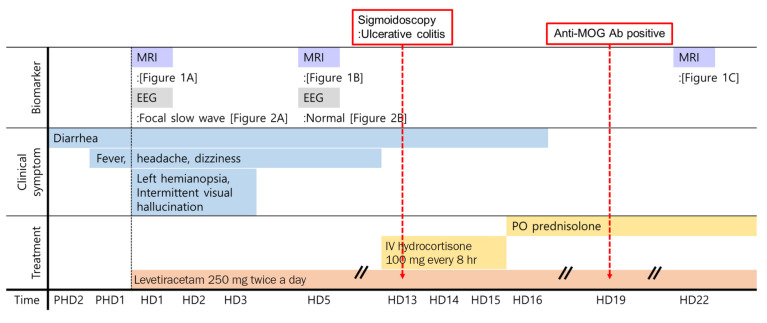 Myelin oligodendrocyte glycoprotein antibody-associated disease presenting as unilateral cerebral cortical encephalitis: a case report.