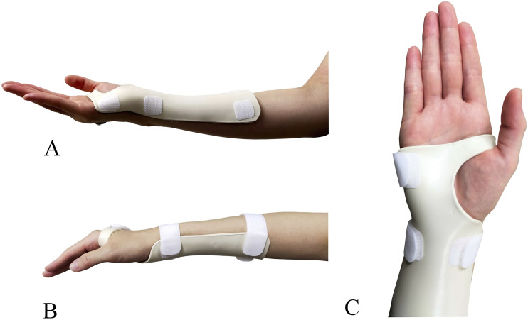 Effect of wrist orthoses on upper limb function, activities of daily living, and stress response.