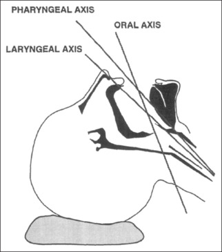 Bed-up-head-elevated Position versus Supine Sniffing Position in Patients Undergoing Rapid Sequence Intubation Using Direct Laryngoscopy in the Emergency Department - A Randomized Controlled Trial.