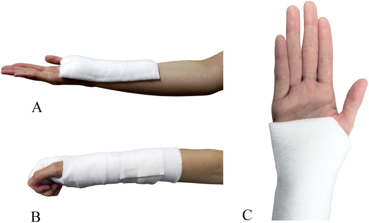 Effect of wrist orthoses on upper limb function, activities of daily living, and stress response.