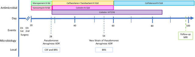 Cefiderocol and Intraventricular Colistin for Ventriculitis due to an Extensively Drug-Resistant <i>Pseudomonas Aeruginosa</i>.