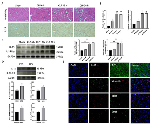 Pretreatment with interleukin-15 attenuates inflammation and apoptosis by inhibiting NF-κB signaling in sepsis-induced myocardial dysfunction.