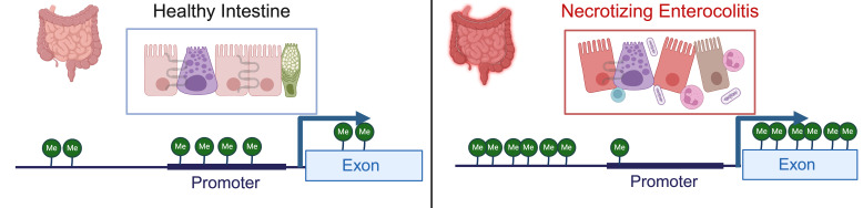 DNA methylation in necrotizing enterocolitis.